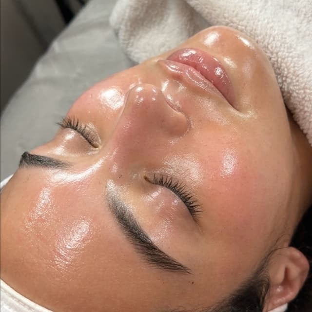 Society Skin Club at Society Skin Lab in Arlington, TX